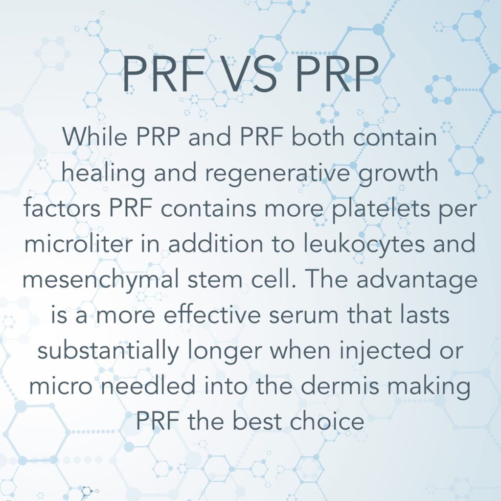 prp vs prf